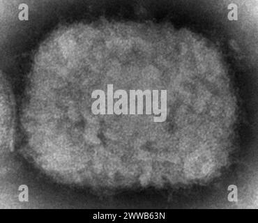 Questa immagine microscopica elettronica (EM) raffigura un virion del vaiolo monkeyico, ottenuto da un campione clinico associato all'epidemia del cane della prateria del 2003. Foto Stock