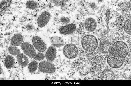 Questa immagine microscopica elettronica (EM) raffigura le particelle del virus del vaiolo monkeyico. Foto Stock