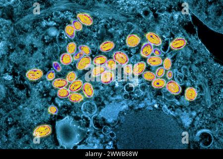 Virus Variola (i poxvirus sono virus di grandi dimensioni di 300/200/100 nm. Foto Stock