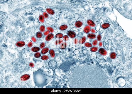 Virus Variola (i poxvirus sono virus di grandi dimensioni di 300/200/100 nm. Foto Stock