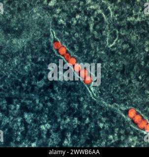 Micrografia elettronica di trasmissione delle particelle del virus del Nilo occidentale (arancione) che si replicano all'interno del citoplasma di una cellula VERA E6 infetta (tè). Foto Stock