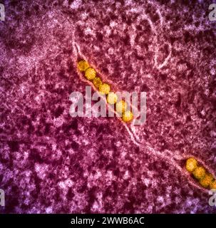 Micrografia elettronica di trasmissione delle particelle del virus del Nilo occidentale (oro) che si replicano all'interno del citoplasma di una cellula infetta VERO E6 (rosa). Foto Stock