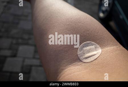 Un cerotto sul braccio destro dopo aver prelevato un campione di sangue dalla vena per l'analisi in laboratorio medico. Concetto di analisi del sangue. Foto Stock