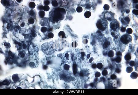 Con un ingrandimento di 1180X, questa fotomicrografia del 1973 di un esemplare macchiato con ematossilina-eosina (HE) ha rivelato la presenza di Naegleria gruberi. Foto Stock