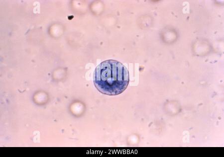 Utilizzando una tecnica di colorazione blu metilene, questo fotomicrografo ha rivelato la presenza di un trofozoite Entamoeba moshkovskii. Foto Stock