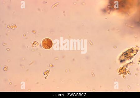 Questa fotomicrografia di un campione macchiato con iodio ha rivelato una cisti di Entamoeba hartmanni, che conteneva un singolo nucleo. Foto Stock