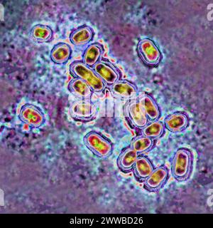 Pneumococco (Streptococcus pneumoniae), pneumococco è un batterio coinvolto in polmonite, broncopolmonite, pleurisia purulenta, meningite batterica. Foto Stock