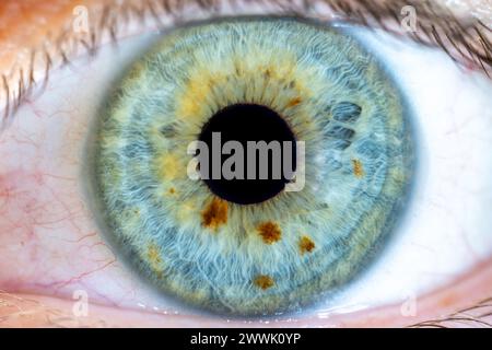 Descrizione: Occhiello femmina di colore verde-blu ad alta risoluzione con macchie di pigmento marrone e pupilla completamente aperta. Primo piano. Anatomia strutturale. Iris umano. Mac Foto Stock