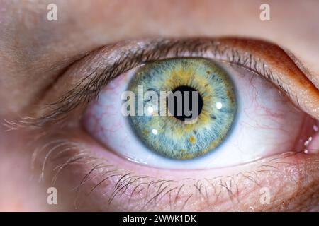 Descrizione: Occhio femminile di colore blu-verde con macchie di pigmento marroni. Pupilla chiusa. Primo piano. Anatomia strutturale. Dettagli macro Human Iris. Foto Stock