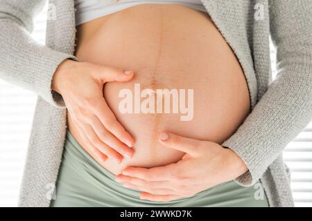 Descrizione: Vista frontale della sezione centrale di una donna irriconoscibile che massaggia delicatamente la pancia negli ultimi mesi di gravidanza. Gravidanza primo trimestre - Wee Foto Stock