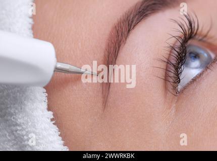 Il cosmetologo effettua il trattamento procedurale di Couperose della pelle del viso di una bella e giovane donna in un salone di bellezza. Cosmetologia e professi Foto Stock