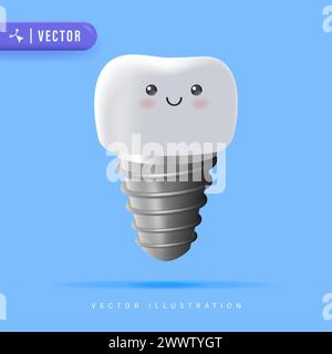 Illustrazione del vettore dell'impianto dentale. Trattamento ortopedico metodo moderno. Illustrazione stomatologica vettoriale isolata su blu. Illustrazione Vettoriale