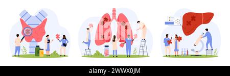 Diagnosi di malattie di organi interni set. Le piccole persone effettuano ricerche con lente d'ingrandimento e microscopio, connettono pezzi di puzzle nella ghiandola tiroidea umana, nel fegato e nei polmoni illustrazioni vettoriali dei cartoni animati Illustrazione Vettoriale