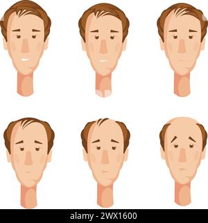 Storyboard con sei teste di carattere maschile cartoon isolate che soffrono di perdita di capelli con espressioni facciali infelice illustrazione vettoriale Illustrazione Vettoriale