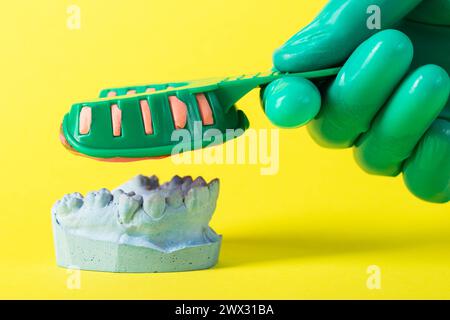 La mano di un medico in un guanto medico verde contiene un cucchiaio dentale con una massa plastica alginata per fare un gesso della mascella del paziente. Malocclusi Foto Stock