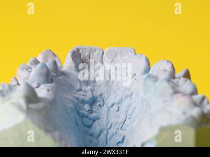 Intonaco blu impressione della mascella dentale di un paziente con denti storti e malocclusioni su sfondo giallo. Produzione di controventature per correggere il morso Foto Stock