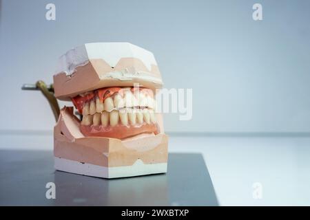 un modello di dentatura su un tavolo da laboratorio. Si tratta della ganascia superiore e inferiore. Foto Stock