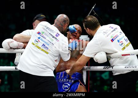 Fabio Wardley in azione contro Frazer Clarke (non nella foto) durante il loro incontro pesante all'O2 di Londra. Data foto: Domenica 31 marzo 2024. Guarda la storia di PA BOXING London. Il credito fotografico dovrebbe essere: John Walton/PA Wire. RESTRIZIONI: Utilizzo soggetto a restrizioni. Solo per uso editoriale, nessun uso commerciale senza il previo consenso del titolare dei diritti. Foto Stock