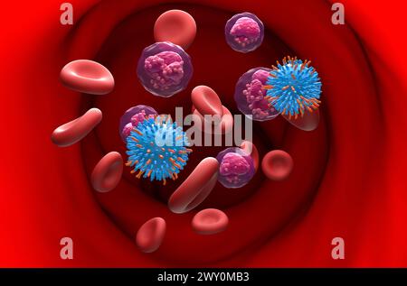 Terapia con cellule T DELL'AUTO nella leucemia linfocitica acuta (TUTTE) - Vista in sezione illustrazione 3d. Foto Stock