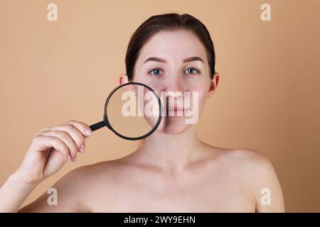 Giovane donna con problemi di acne tenendo la lente di ingrandimento vicino alla pelle su sfondo beige Foto Stock