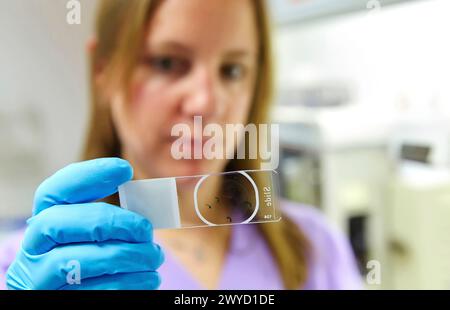 Citologia, patologia anatomica, ospedale Donostia, San Sebastian, Gipuzkoa, paesi Baschi, Spagna. Foto Stock