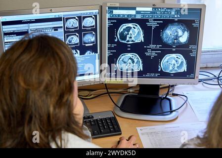 Comitato di tumori, Oncologia, sessione clinica, ospedale Donostia, San Sebastian, Gipuzkoa, Paesi Baschi, Spagna. Foto Stock