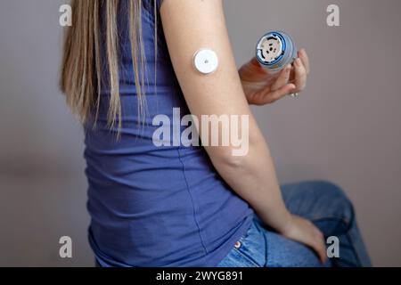 Ragazza che applica il cerotto di monitoraggio del glucosio flash sul braccio Foto Stock