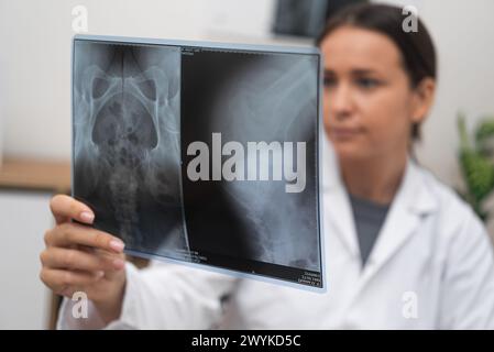 Servizio sanitario medico, medico preoccupato guarda la pellicola radiologica a raggi X per una diagnosi precisa Foto Stock