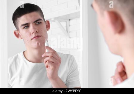 Giovane uomo con problemi di acne che applica il prodotto cosmetico sulla pelle vicino allo specchio in interni Foto Stock