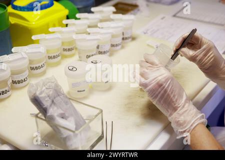 Manipolazione dei campioni, anatomia patologica. Hospital de Zumarraga, Gipuzkoa, Euskadi, Spagna. Foto Stock