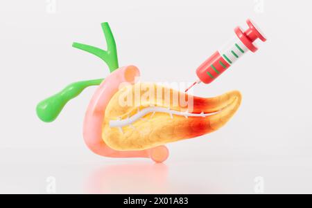 Pancreas umano, modello d'organo della cistifellea, pancreatite e terapia farmacologica, rendering 3d. illustrazione 3d. Foto Stock