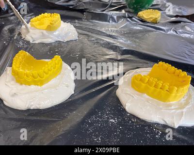 Studi di denti modello degli studenti della Facoltà di Odontoiatria. Foto Stock