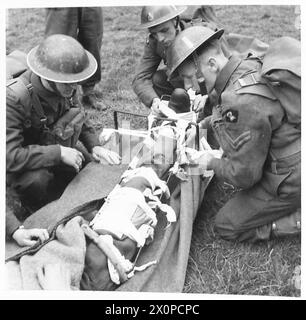 SERVIZI MEDICI - varie fasi dell'applicazione del Thomas Splint Photographic negative , British Army Foto Stock