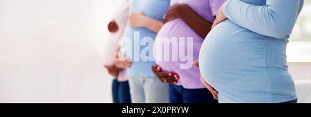 Gruppo eterogeneo di donne incinte in piedi di fila. Foto Stock