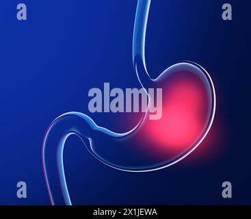 Illustrazione 3D dello stomaco con bruciore. Taglio anatomico di vetro trasparente con luci e riflessi su sfondo blu scuro. Foto Stock