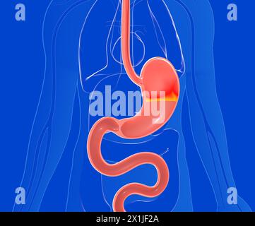 Illustrazione anatomica 3D dello stomaco con bruciore di stomaco e reflusso. Su un corpo umano in vetro trasparente visto dalla parte anteriore. Sfondo blu scuro. Foto Stock