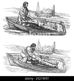 Trattamento restaurativo dell'apparentemente annegato: Il metodo del dottor Silvester di indurre la respirazione, 1864. Illustrazioni per il '...instructions per la rinascita di persone apparentemente annegate, che la Royal National Life-boat Institution ha ultimamente compilato... ispirazione; espirazione... I punti su cui puntare sono - in primo luogo e immediatamente, il ripristino della respirazione; e, in secondo luogo, dopo il ripristino della respirazione, la promozione del calore e della circolazione. Gli sforzi per ripristinare la respirazione devono essere iniziati immediatamente ed energicamente, e perseverati per una o due ore, o fino a quando un medico non ha p Foto Stock