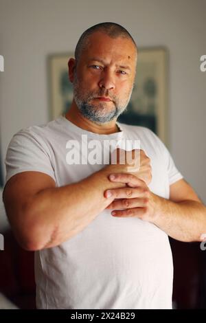 uomo con una cicatrice sulla spalla Foto Stock