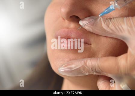 Iniezione di aumento delle labbra per le giovani donne Foto Stock