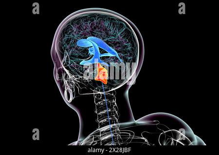 Ingrandimento del quarto ventricolo cerebrale, illustrazione Foto Stock