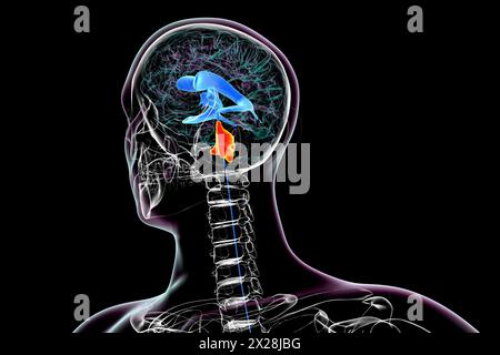 Ingrandimento del quarto ventricolo cerebrale, illustrazione Foto Stock