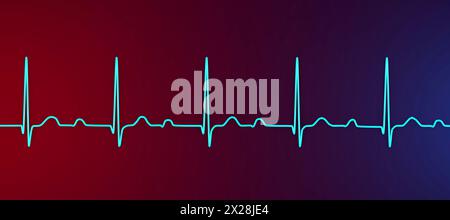 ECG con blocco AV di primo grado, illustrazione Foto Stock