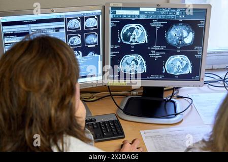 Comitato dei tumori, oncologia, sessione clinica, Ospedale Donostia, San Sebastian, Gipuzkoa, Paesi Baschi Foto Stock