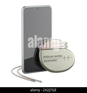 Pacemaker cardiaco artificiale con smartphone, rendering 3D isolato su sfondo bianco Foto Stock