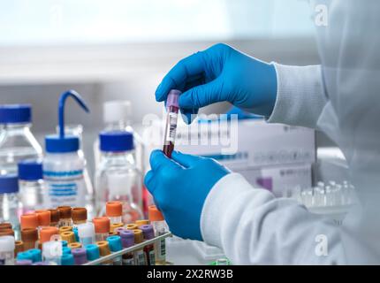 Scienziato che tiene la provetta per il campione di sangue in laboratorio Foto Stock