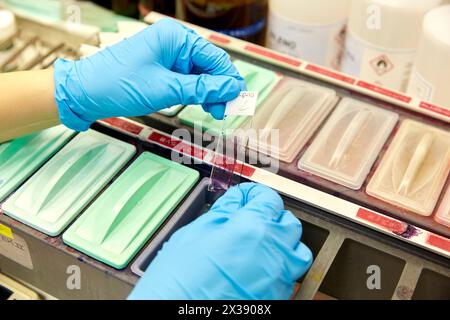 Citologia, Patologia anatomico, Ospedale Donostia, San Sebastian, Gipuzkoa, Paesi Baschi Foto Stock