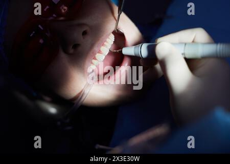 Il dentista effettua la pulizia dei denti a ultrasuoni per il paziente utilizzando strumenti speciali nella clinica odontoiatrica. Foto Stock