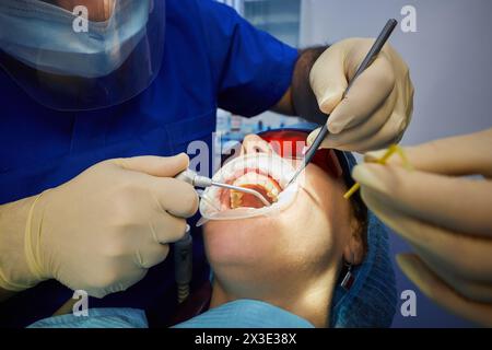 Primo piano mani di medico, assistente con strumenti che posizionano corona su denti e viso con bocca aperta di donna in sedia dentista in studio stomatologo Foto Stock