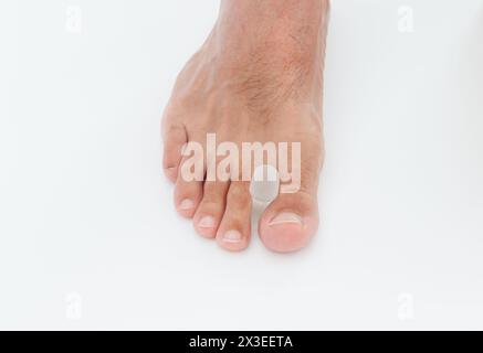 Separatore di puntali in silicone per puntale bunion o allux valgus. Foto Stock