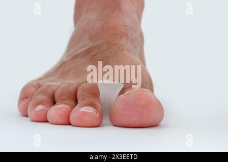 Separatore di puntali in silicone per puntale bunion o allux valgus. Foto Stock